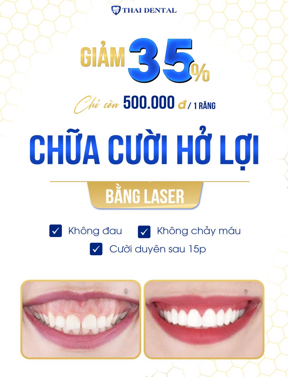 cuoi-ho-luoi